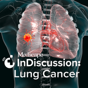 Podcast Medscape InDiscussion: Lung Cancer