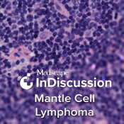 Podcast Medscape InDiscussion: Mantle Cell Lymphoma