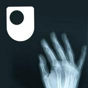 Podcast Rheumatoid arthritis - a long term condition - for iPad/Mac/PC
