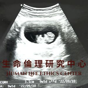 天主教生命倫理